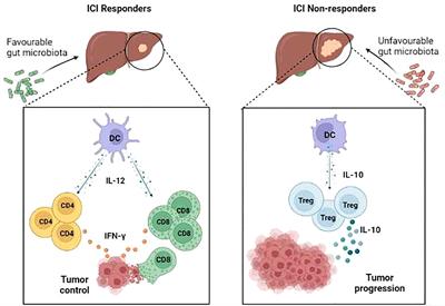 Potential predictive role of gut microbiota to immunotherapy in HCC patients: a brief review